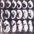 初始化胚胎比對示意圖