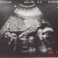 【超音波照時間】懷胎中2009年3月12日