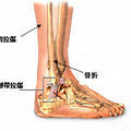 腳踝扭傷經常發生