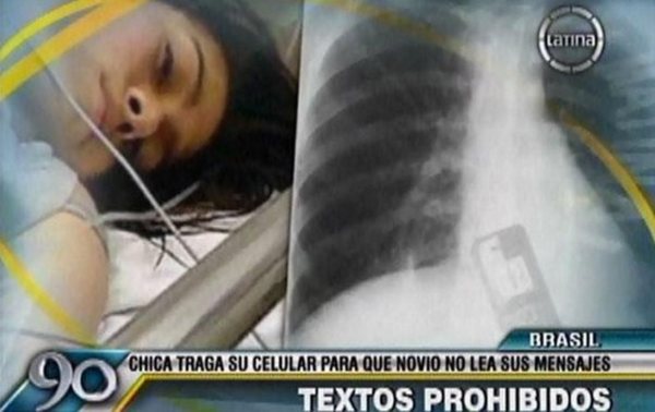 X光很明顯照出手機在腹中的位置。(圖/截自lapatilla.com)