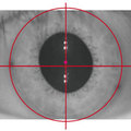 瞳孔大小的變化導致中心點位