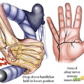 手部尺神經分佈圖