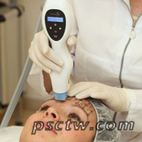 電波拉皮的優點、缺點、效果、副作用後遺症、價格費用