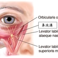 Levator Labii superioris alaeque nasi